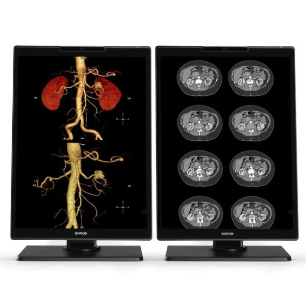Barco Nio Color 21.3″ 3MP (MDNC‑3521) – Set of 2