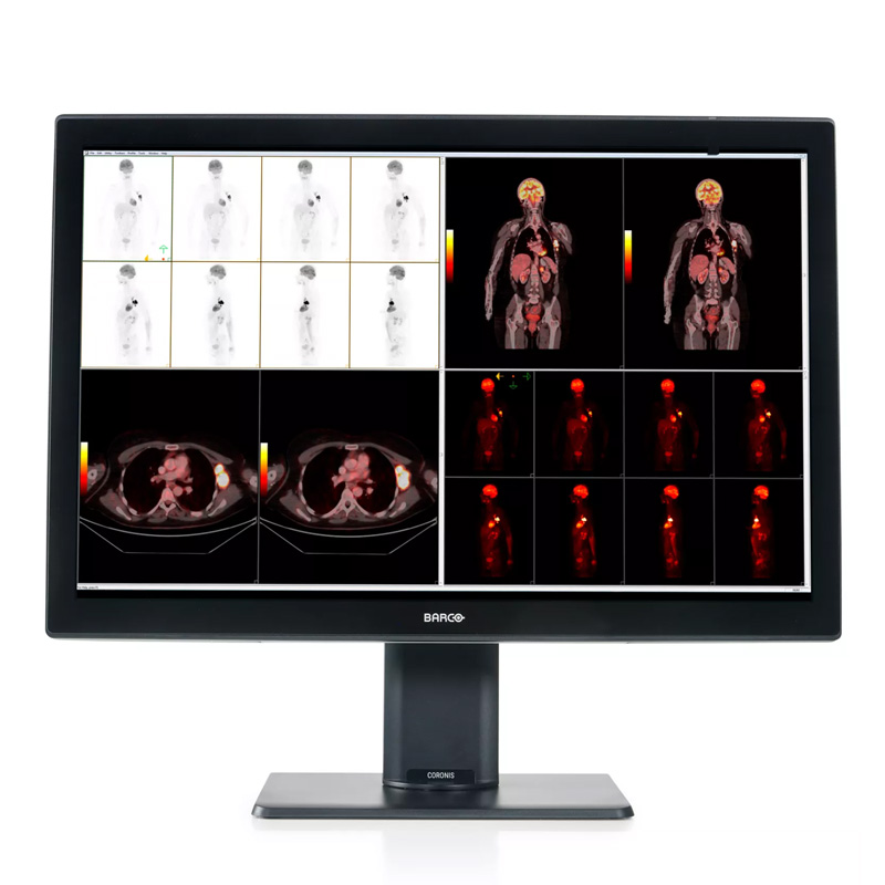 Barco Coronis Fusion 30.4" 6MP (MDCC‑6530)