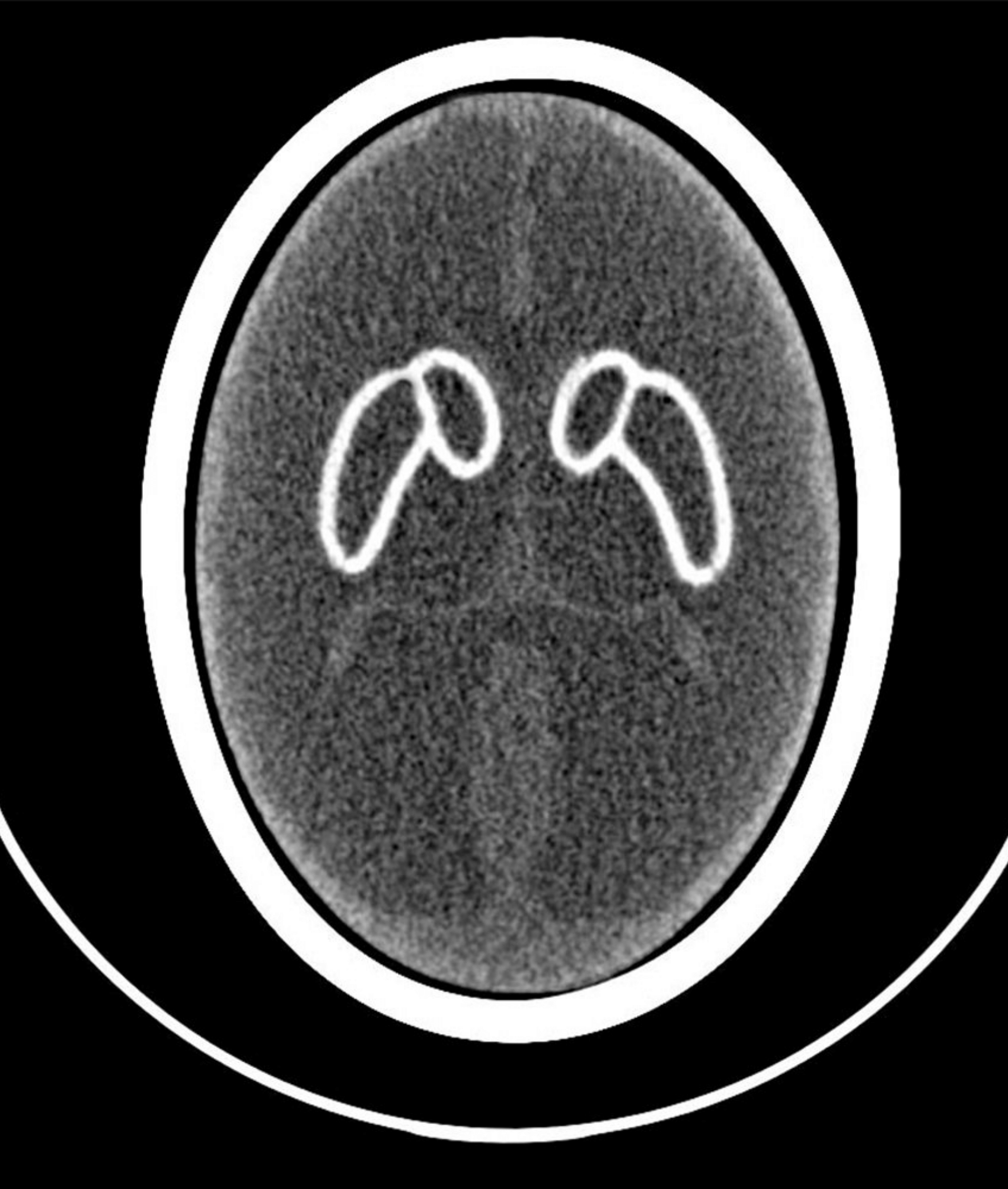Brain Phantom IB-20 advanced (PH-53) - Image 3