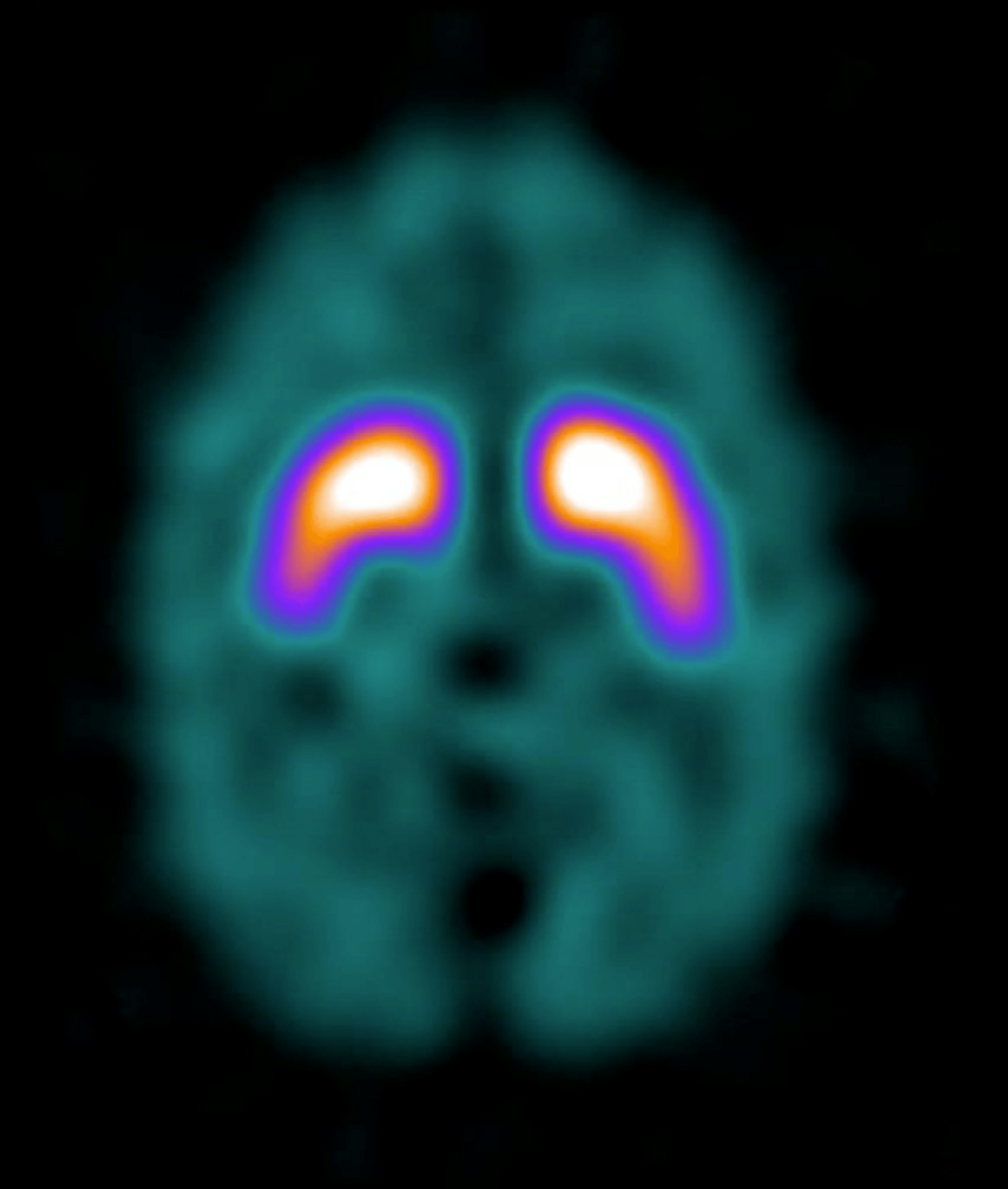 Brain Phantom IB-20 advanced (PH-53) - Image 4