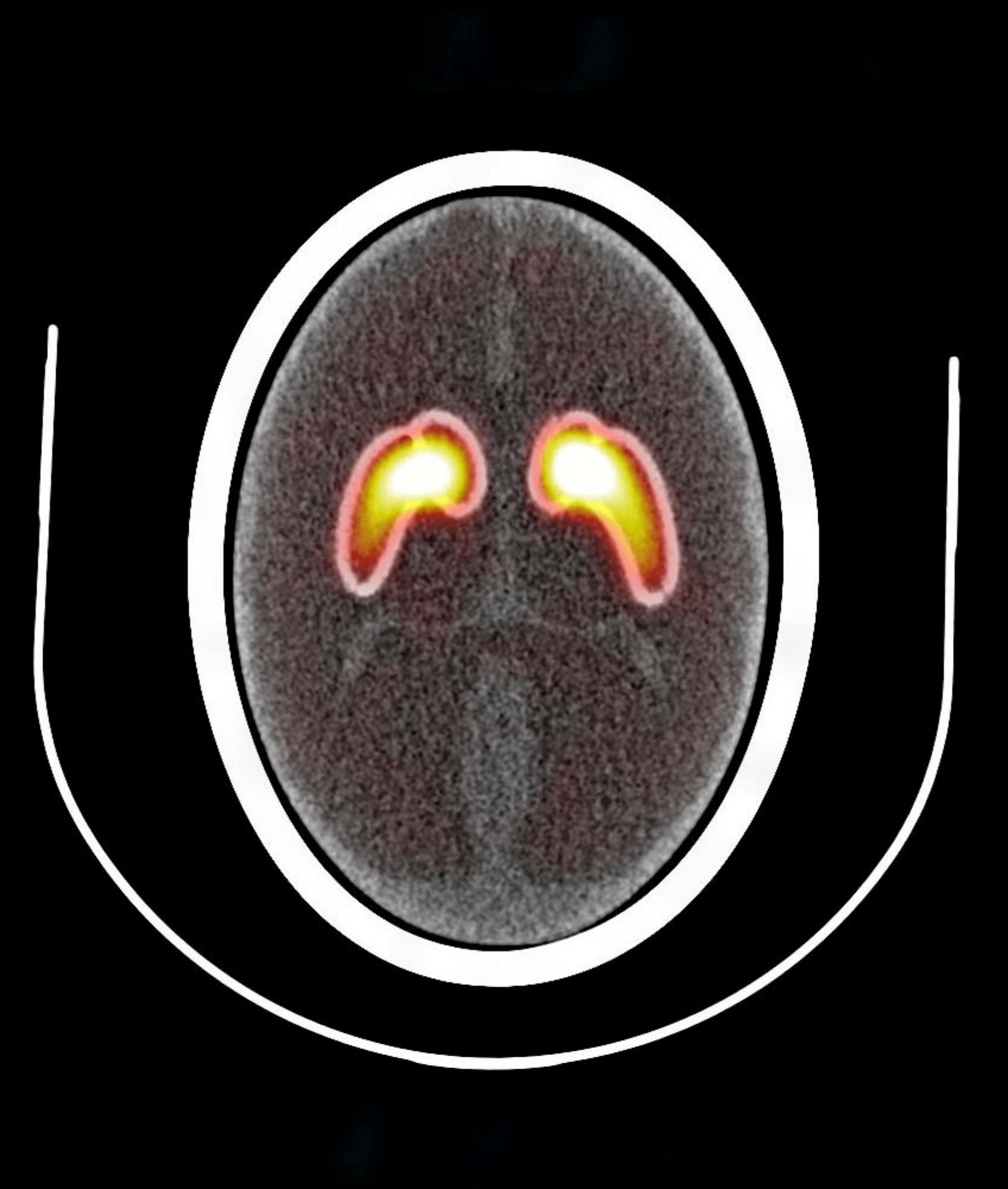 Brain Phantom IB-20 advanced (PH-53) - Image 5