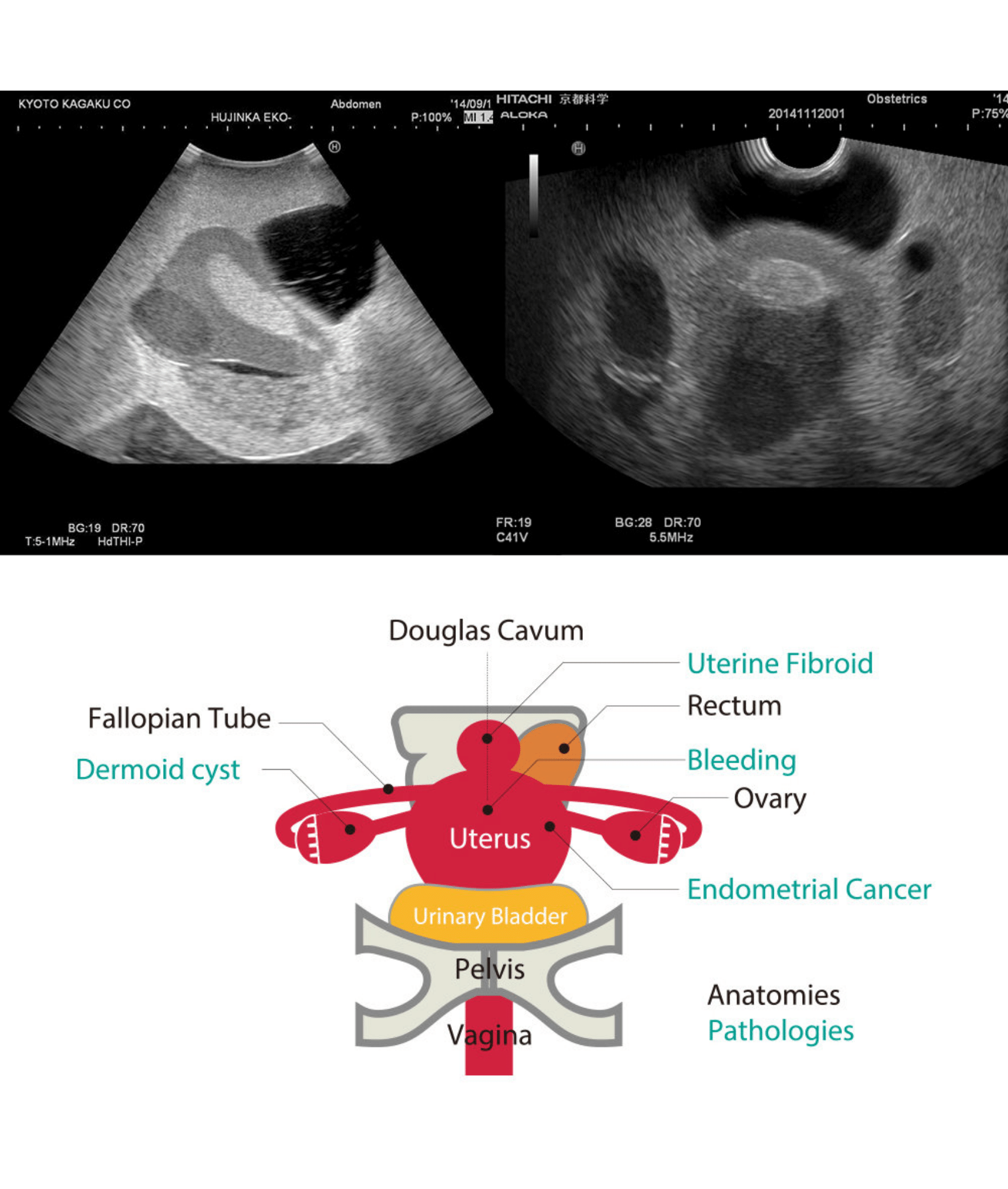 Female Pelvic Ultrasound Phantom (3 units/10W) (US-10C) - Image 4