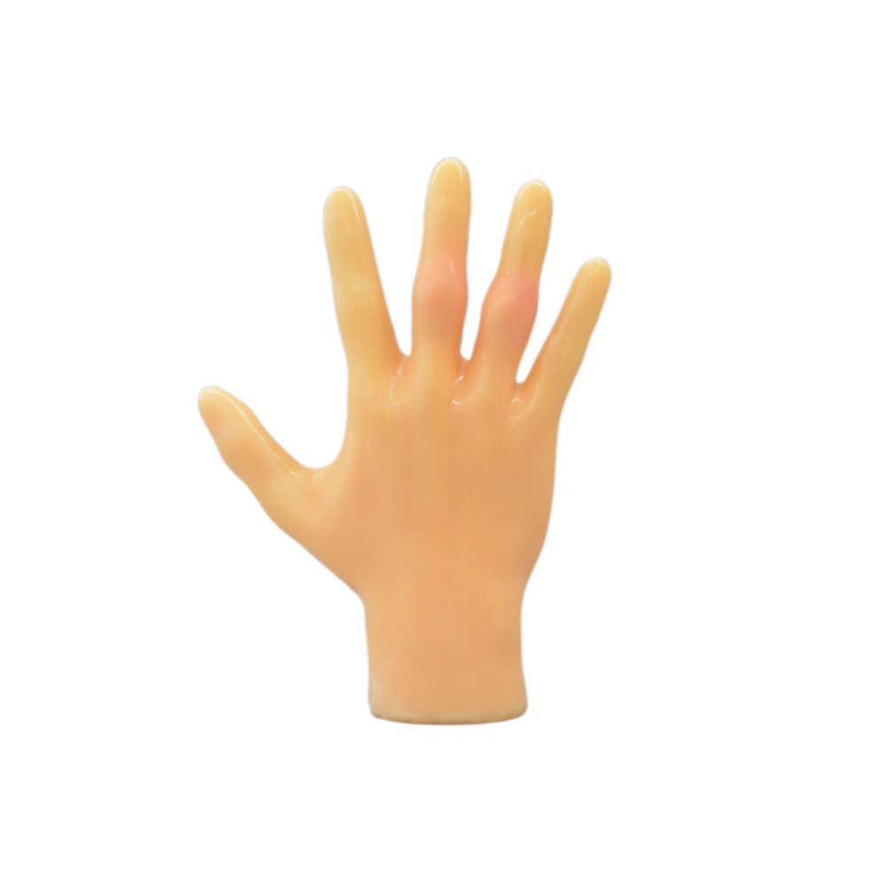 Rheumetoid Finger Phantom (US-17)
