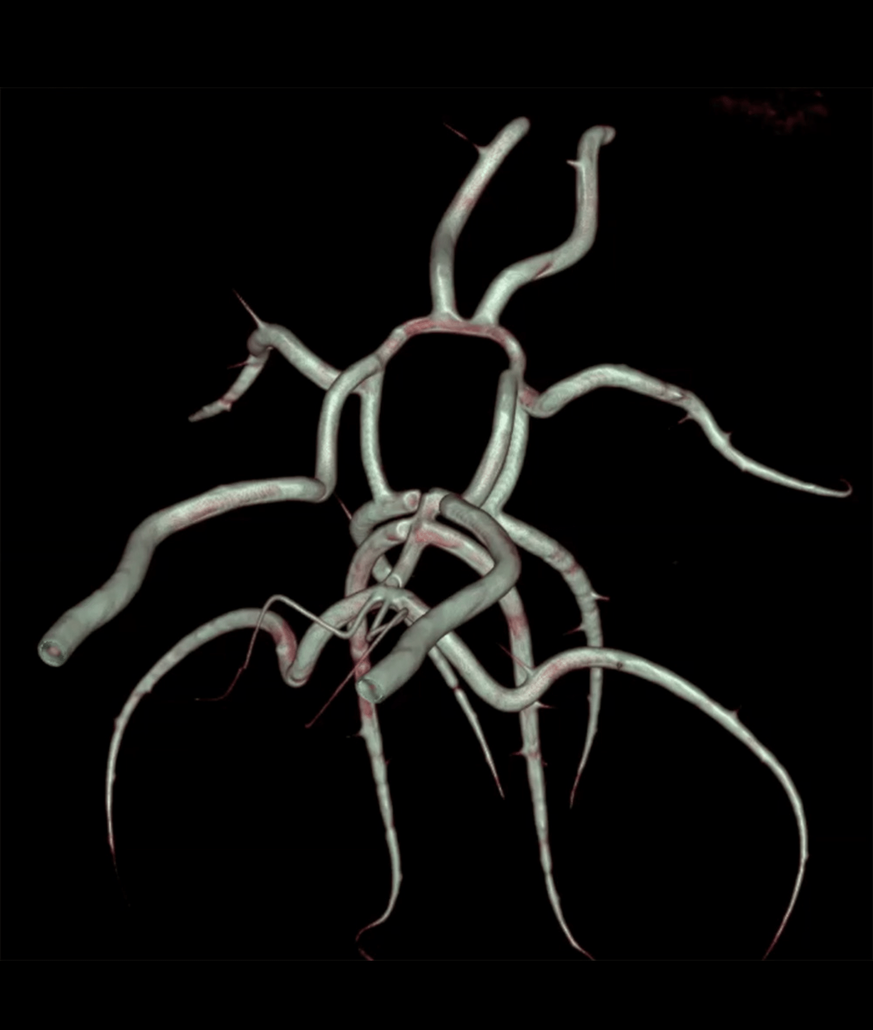 Circle of Willis