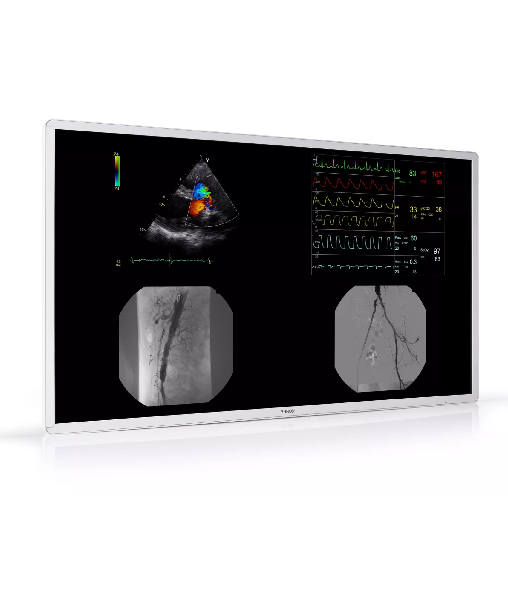 MDAC‑8355 - 4K UHD multi-modality, medical-grade ITE display