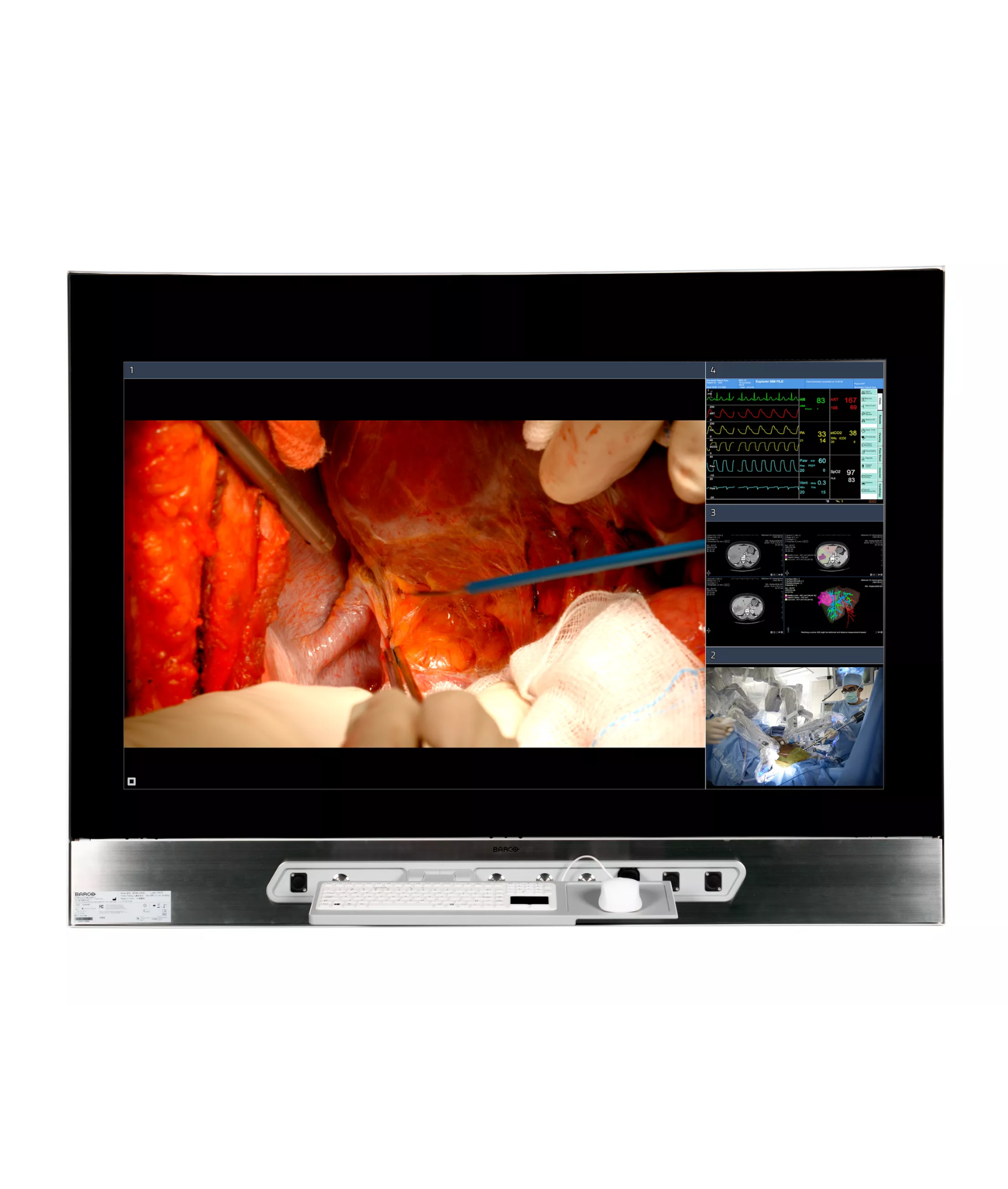 MDMX‑25500 GNNB