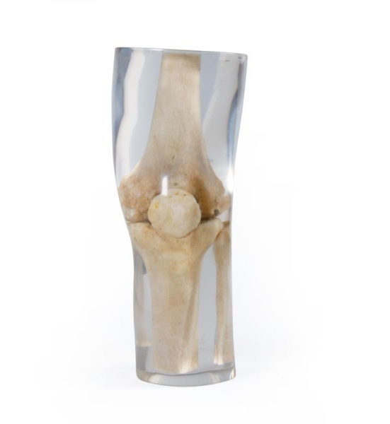 X-Ray Phantom Knee