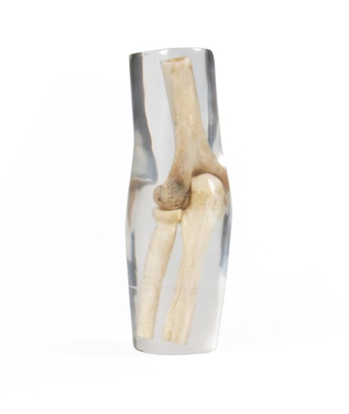 X-Ray Phantom Elbow