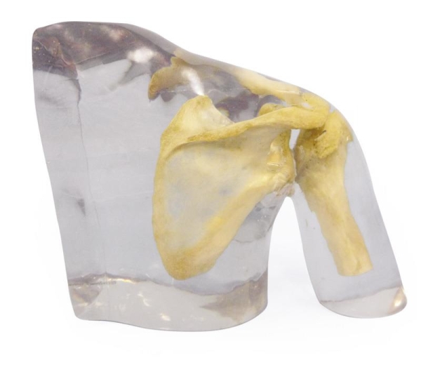 X-ray phantom shoulder