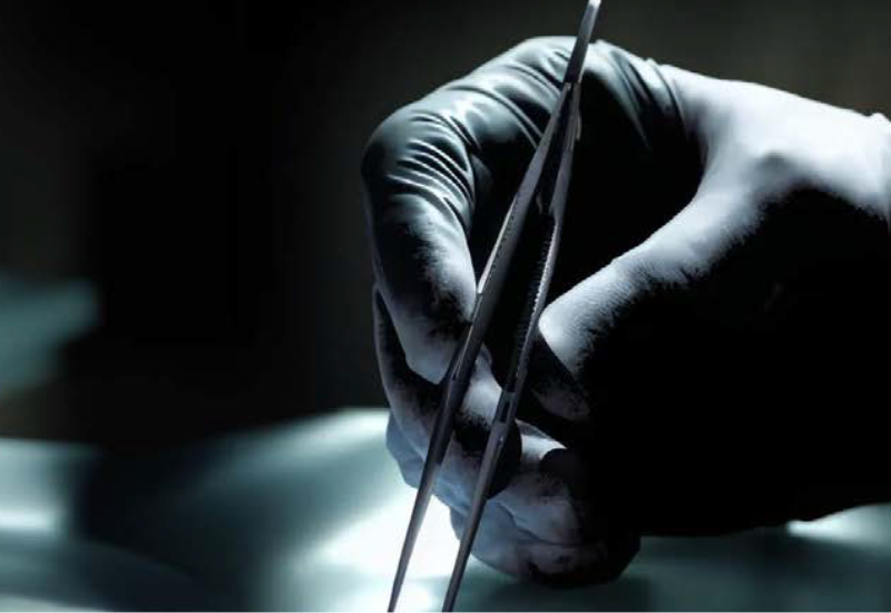 Radiation Attenuating Gloves