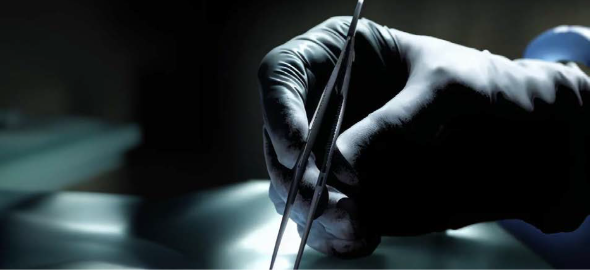 Radiation Attenuating Gloves