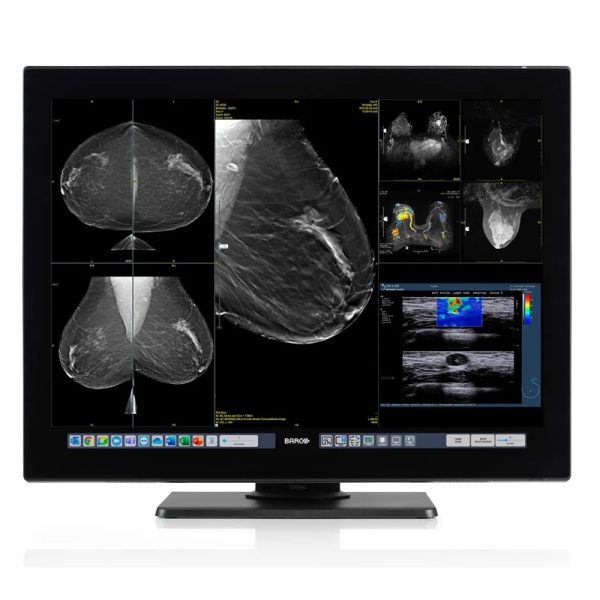 Barco Coronis OneLook 33