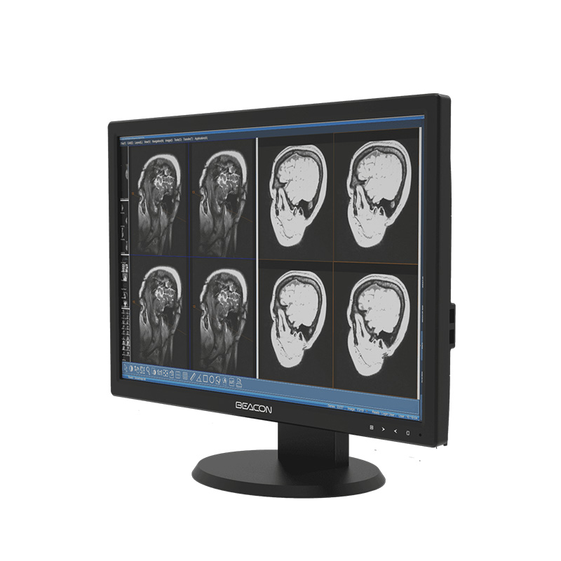 Beacon 24" 2MP Clinical Display (HL2416SH) - Image 3