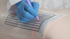 The Fast Find Grid: CT Guided Biopsy Grid