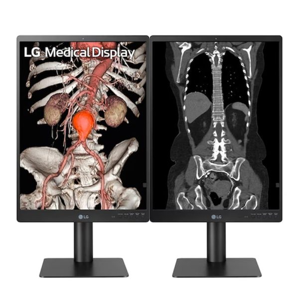 LG 21.3'' 3MP IPS (21HQ513D-B)