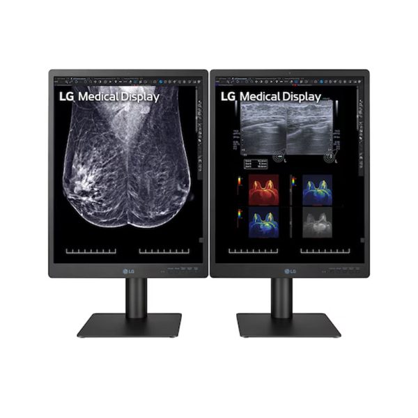 LG 21.3