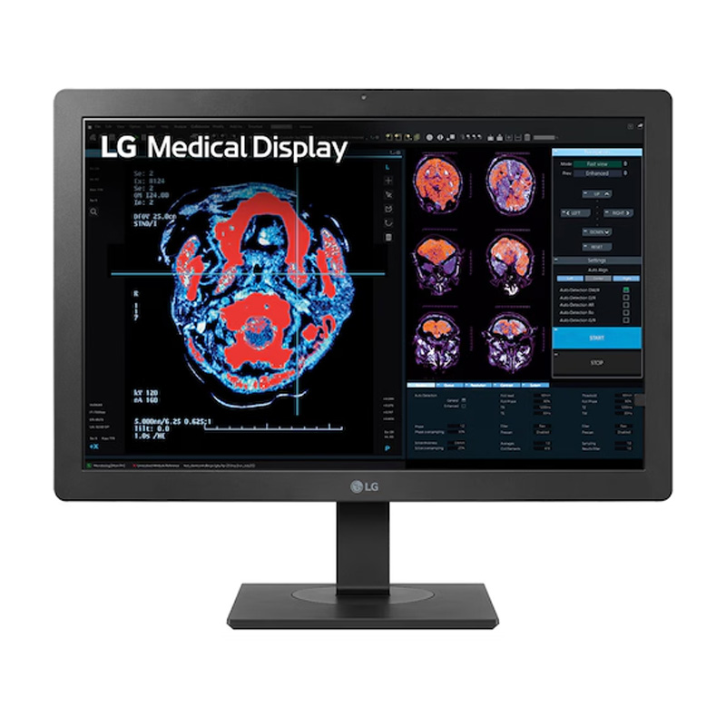 LG 24" 2MP (24HR513C-B)