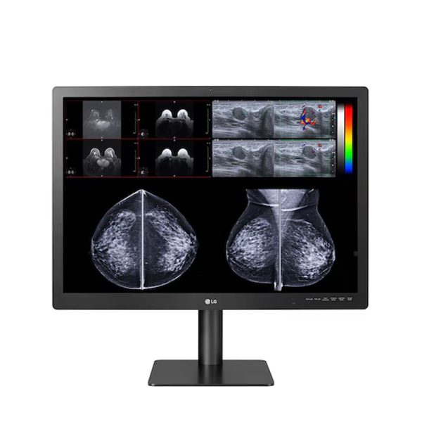 LG 31” IPS 12MP Diagnostic Monitor for Mammography (31HN713D-B)