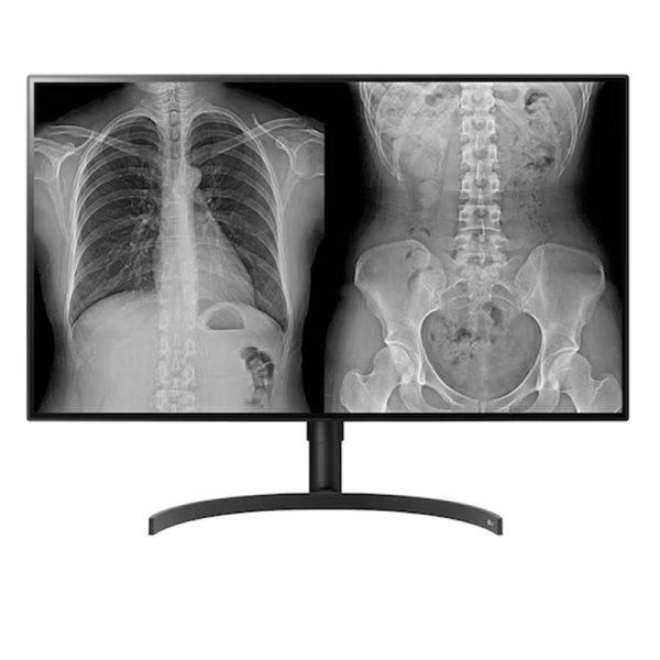 LG 31.5” IPS 8MP (32HL512D-B)