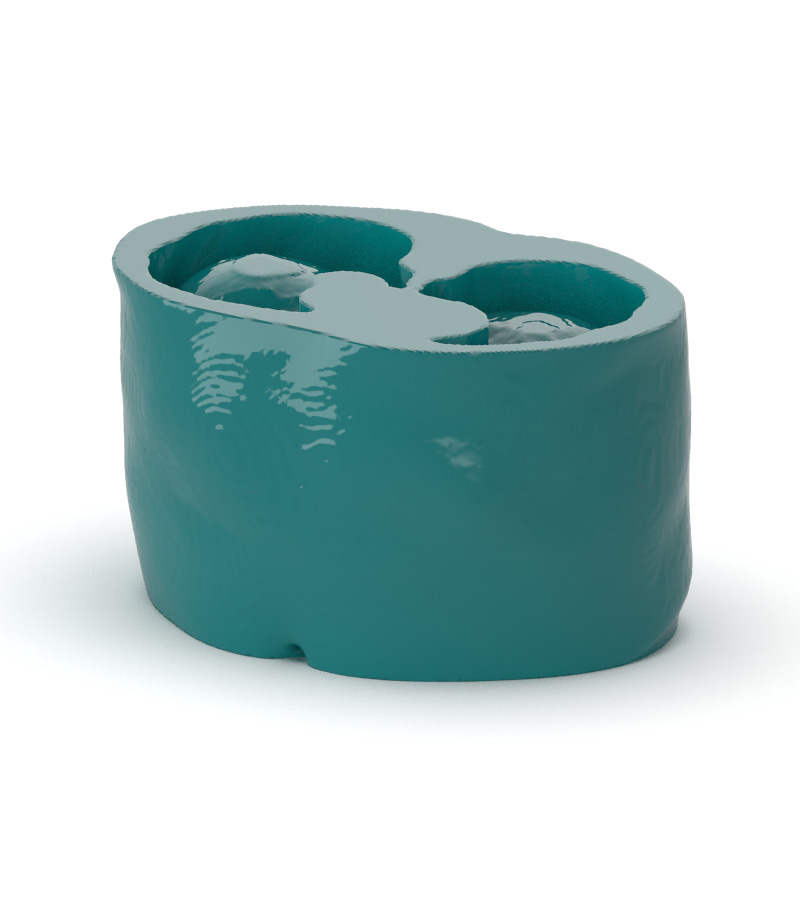 Abdomen Low-Contrast Spheres Phantom - Nature Line