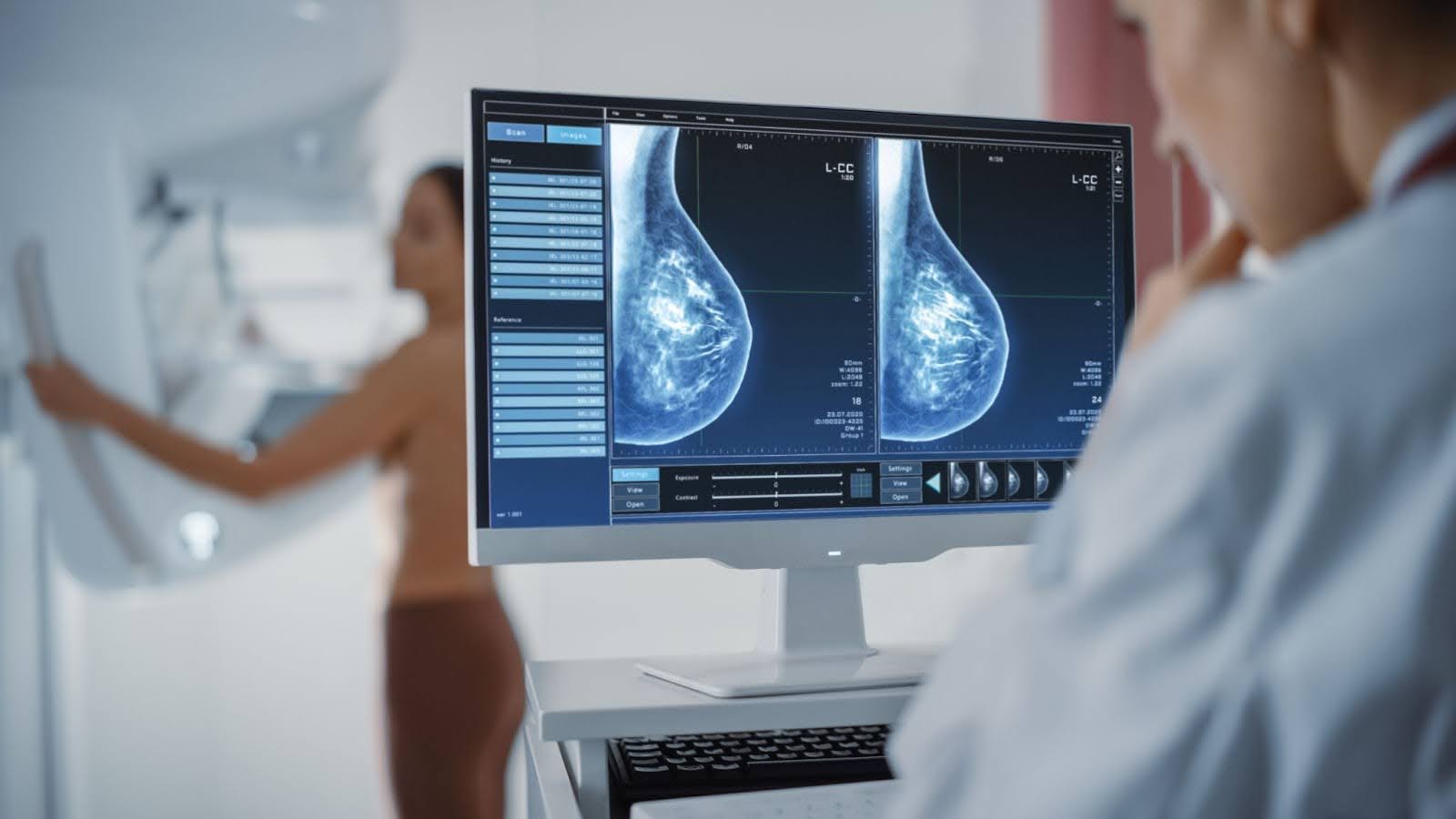 Mammography Spots Designed for Clear Communication in Breast Imaging