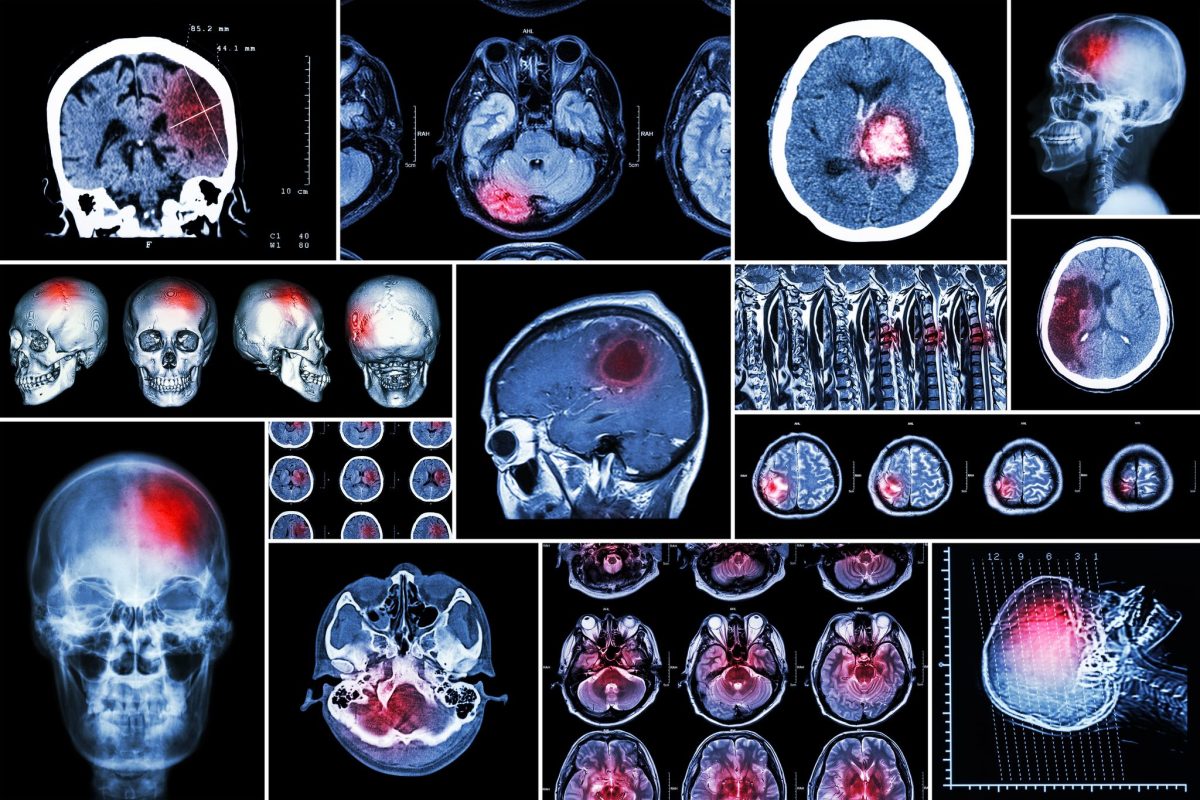 Is Your Imaging Workflow Ready for AI?