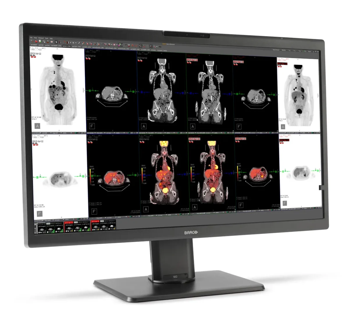 One Cable. More Flexibility. Meet the Next Generation of Barco Medical Displays.